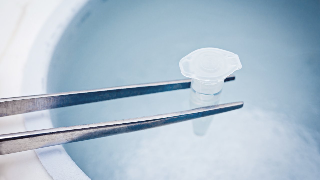 IVF Elective Egg Freezing (EEF)