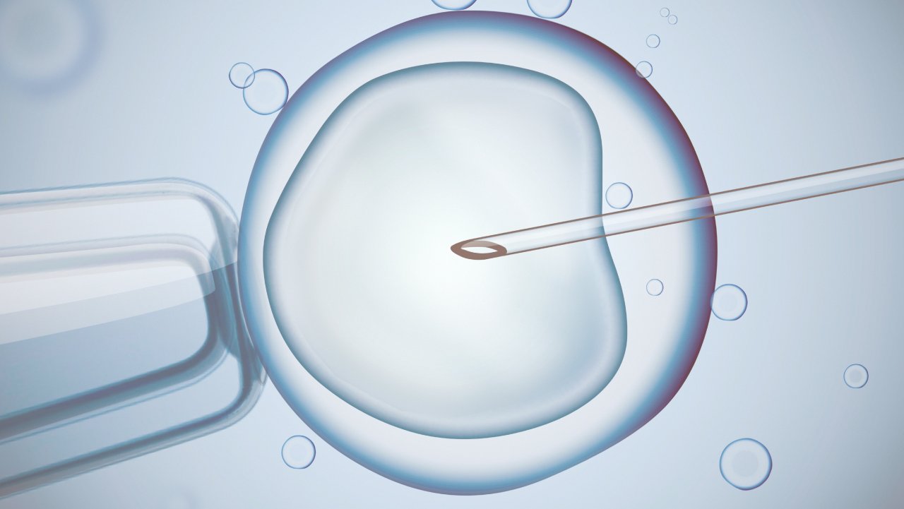 IVF ICSI (Intracytoplasmic Sperm Injection)