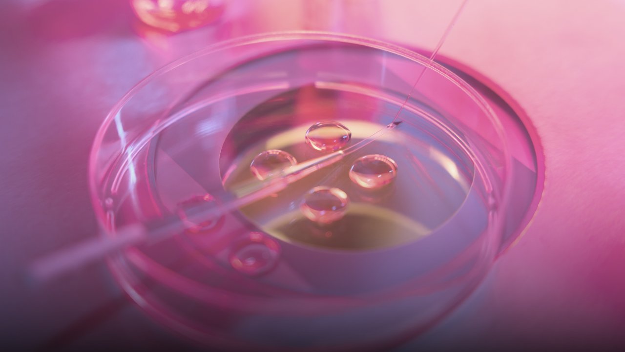 IVF Embryo Transfer